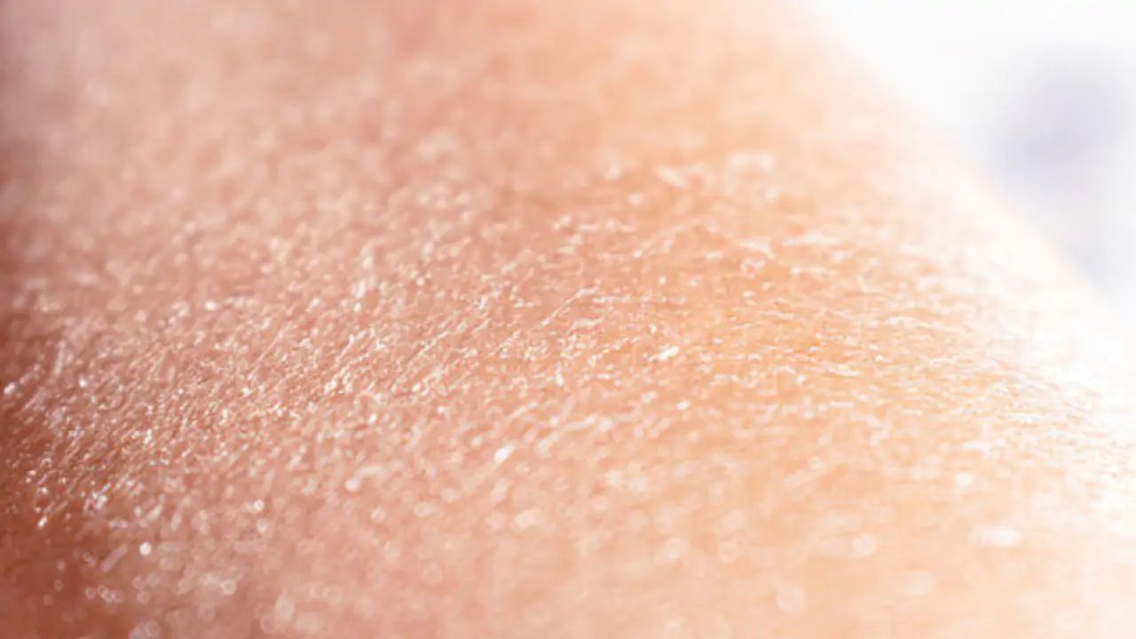 Tác hại của nước nhiễm phèn