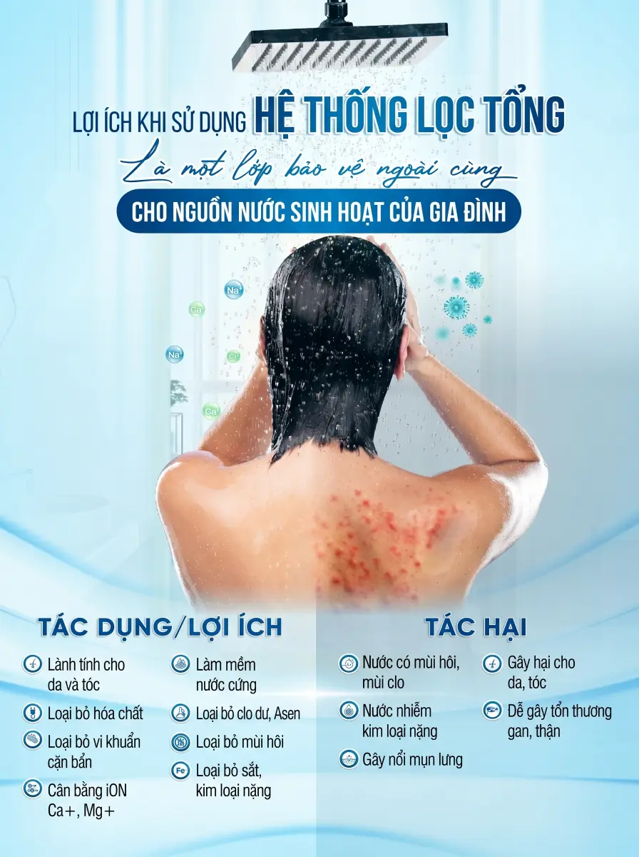 Hệ thống lọc tổng đầu nguồn Fuji Smart APT 200 Plus đem lại nhiều lợi ích